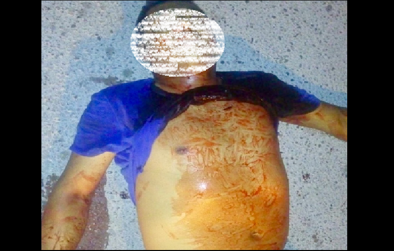 De una certera puñalada asesinaron a un hombre en Acuña