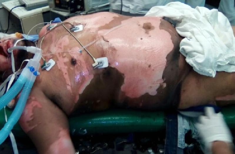 Murió el conductor de tráiler que protagonizó un accidente en Piedras Negras