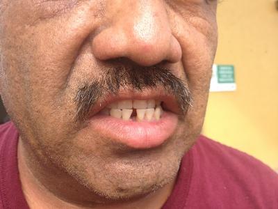 No han declarado policías de Piedras Negras acusados de golpear a detenido