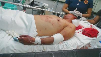 Investigan caso de taxista agredido a navajazos en Piedras Negras
