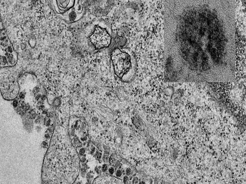 Revelan primeras imágenes de células con coronavirus
