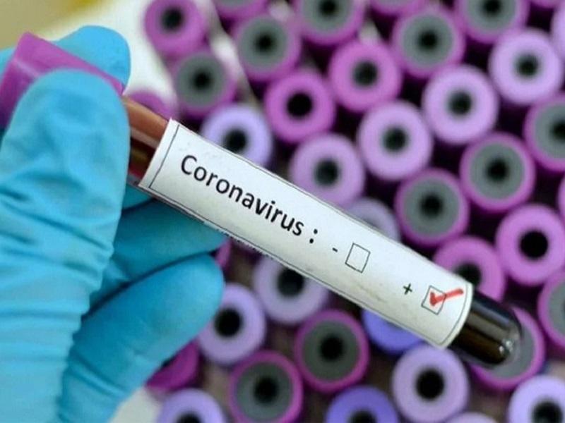 Hay más de 64 mil infectados de coronavirus en todo el mundo