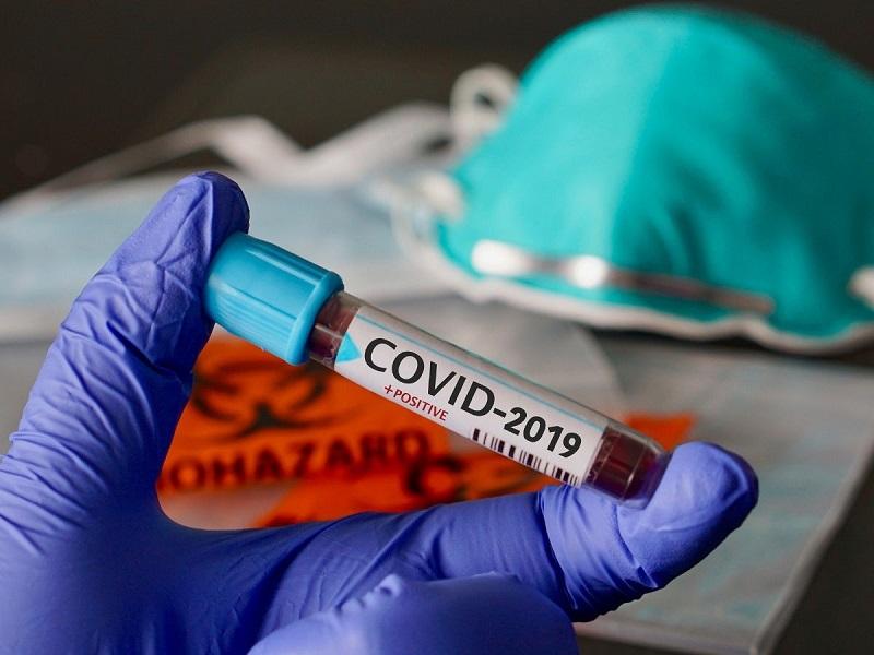 Coronavirus, el alto costo para la econom&iacute;a mundial