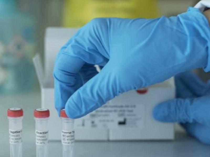 Hay un nuevo caso de Coronavirus en Coahuila, una mujer de Torre&oacute;n; suman 15 casos 