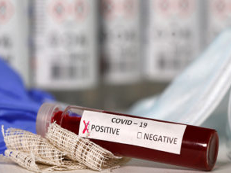 El 60% de los pacientes enviados a laboratorio particular se niegan a realizarse la prueba COVID 19