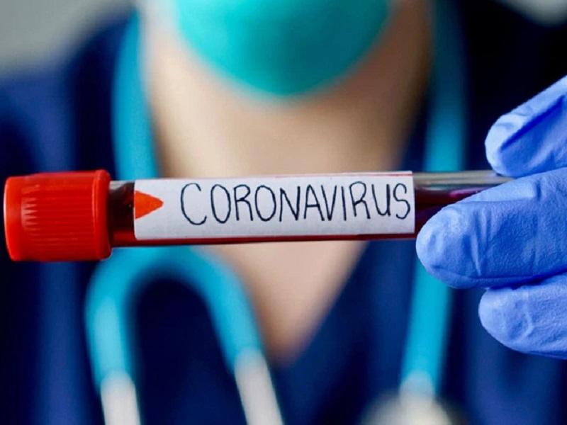 Llega Coahuila a 70 casos de COVID-19; dos m&aacute;s en Monclova