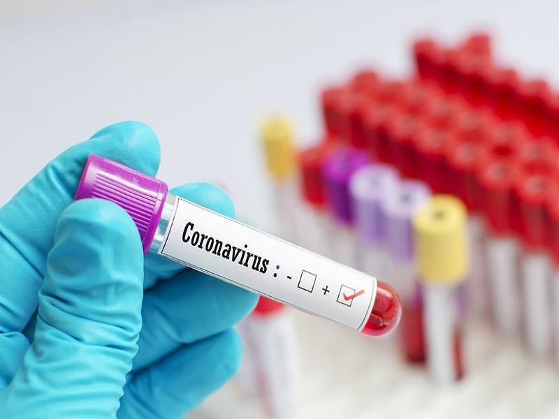 Tendr&iacute;a Coahuila 31 mil infectados de coronavirus en el panorama severo: Salud