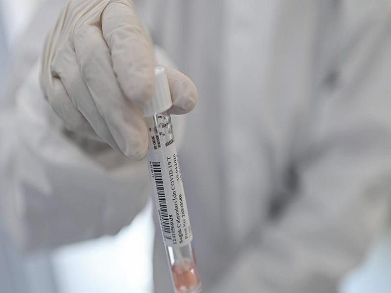 Coronavirus se filtr&oacute; de un laboratorio chino y se ocult&oacute; su origen, afirma documental