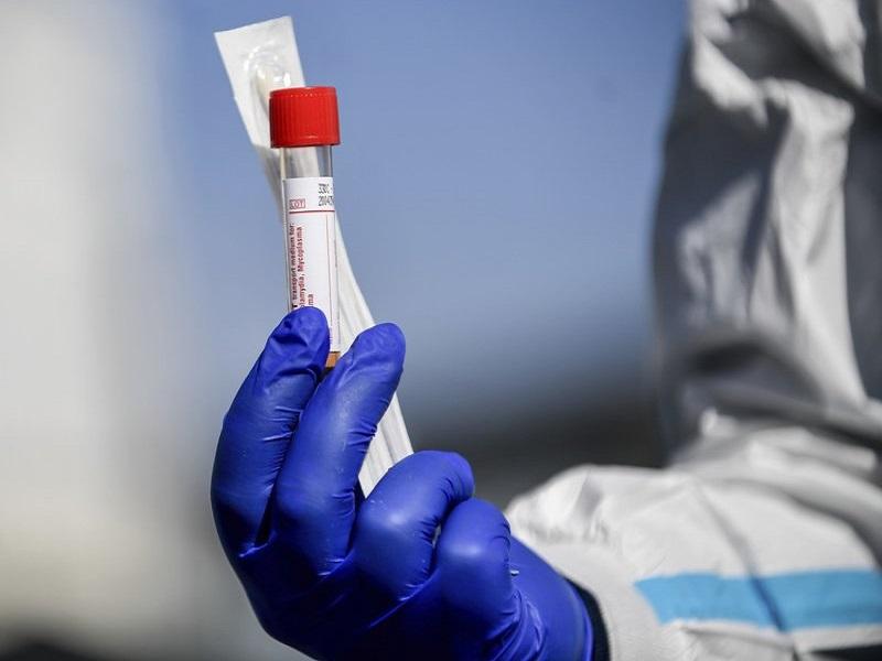 Reino Unido iniciar&aacute; fabricaci&oacute;n masiva de vacuna contra COVID-19 antes de terminar las pruebas