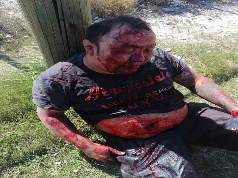 Intent&oacute; matar a su padrastro de varias cuchilladas, lo dej&oacute; grave y abandonado en un terreno bald&iacute;o; fue detenido (video)