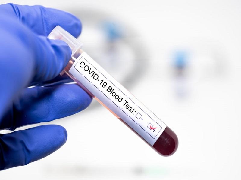 Hay m&aacute;s de 2.7 millones de infectados de COVID-19 en el mundo; 781 mil se han recuperado