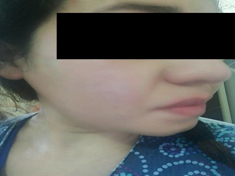 No hay denuncia de enfermera por tocamientos