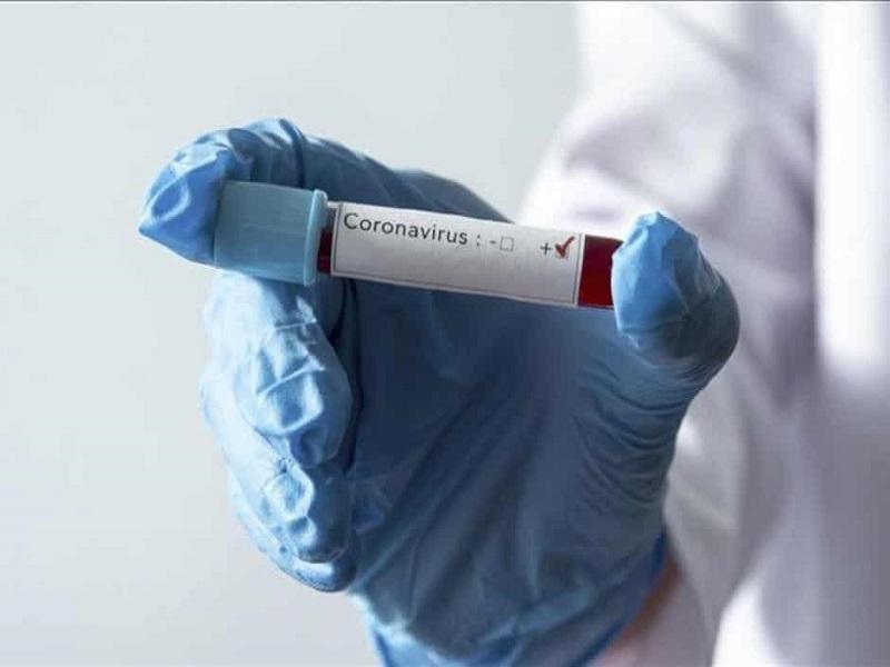 Suma Nuevo Le&oacute;n 664 casos positivos de COVID-19, hay 100 sospechosos