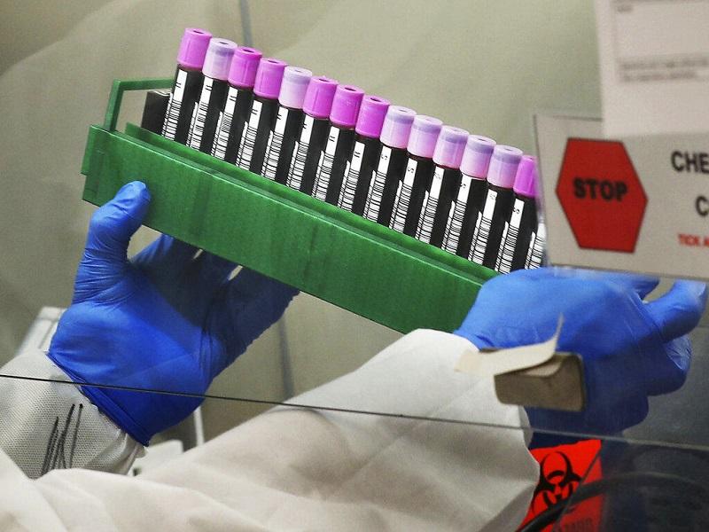 Suman 17 fallecidos y 686 contagiados de COVID-19 en Nuevo Le&oacute;n