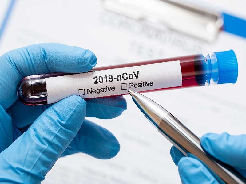 Un hombre de 30 a&ntilde;os dedicado al hogar, el caso 43 de coronavirus en Piedras Negras