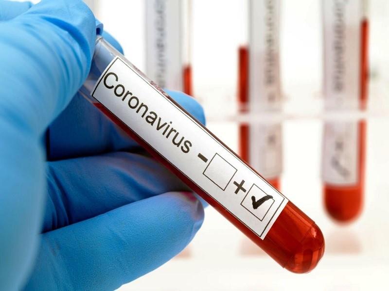Son asintom&aacute;ticos 2 de los nuevos casos de coronavirus en Acu&ntilde;a, uno ya fue dado de alta