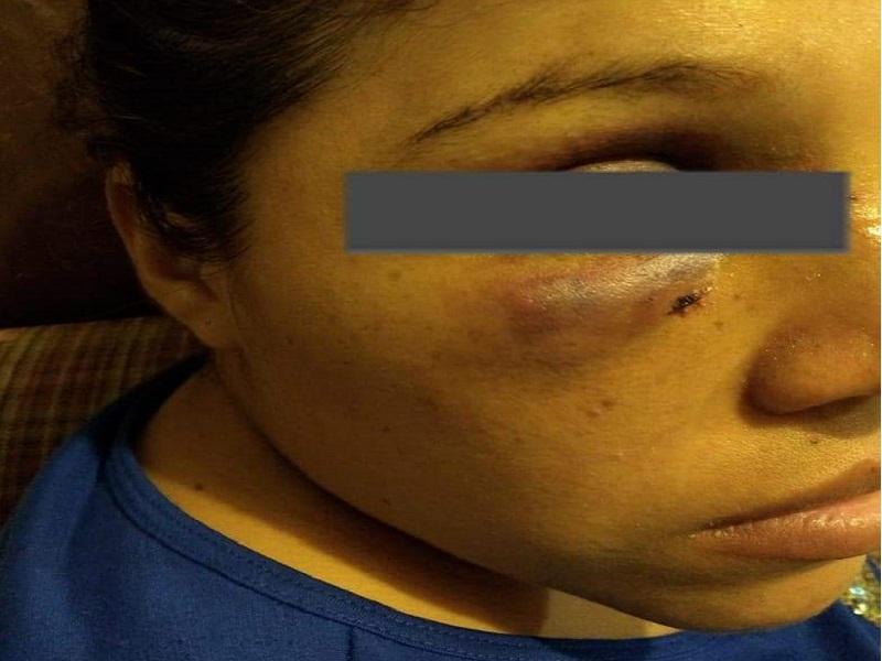 Judicializarán denuncia de mujer golpeada que fue a dar al hospital