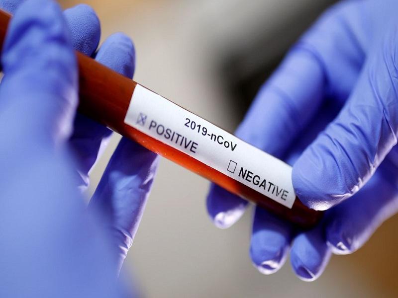 Otra ama de casa, el contagio 60 de coronavirus en Piedras Negras; en Nava suman 3 casos