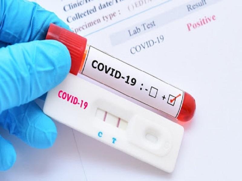 Dos amas de casa, los nuevos contagios de coronavirus en Piedras Negras; una est&aacute; grave en el IMSS; van 80 y 7 en Nava