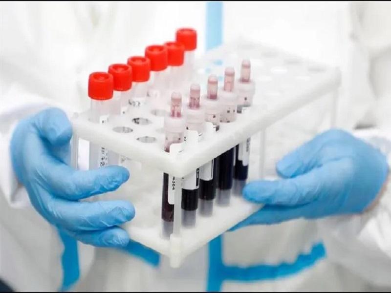 Han muerto m&aacute;s de 408 mil personas por coronavirus en el mundo