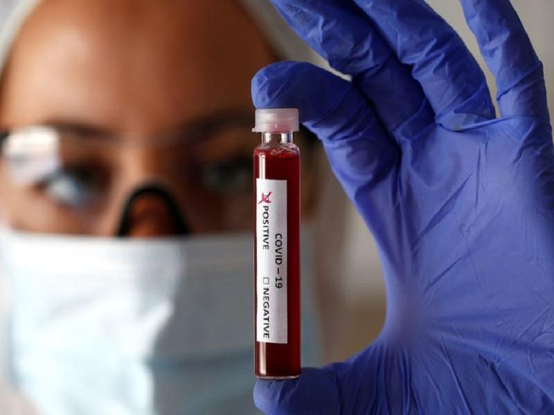 Registra Coahuila dos muertes y 80 contagios de coronavirus en 24 horas; van 2 mil 328 y 114 decesos