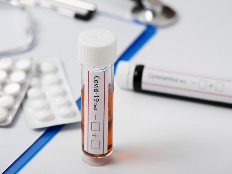 Texas podr&iacute;a cerrar otra vez ante dram&aacute;tico incremento de contagios de coronavirus