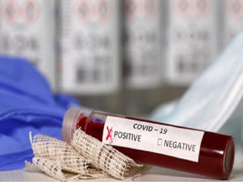 Si presentas s&iacute;ntomas m&aacute;s severos que los de un resfriado com&uacute;n, es probable que tenas COVID-19: Alerg&oacute;logo