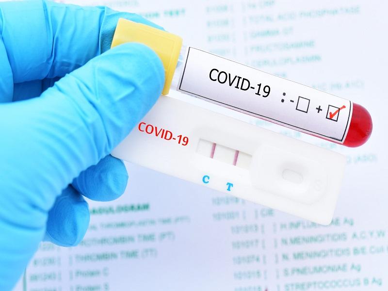 Prueba de PCR determina si alguien es portador o no del SARS-Cov2, no es pronóstico para COVID-19: Salud