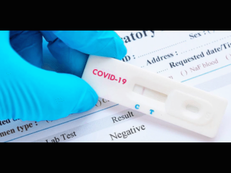 Revisa Salud lugares que ofertan pruebas rápidas de Covid-19 en Piedras Negras