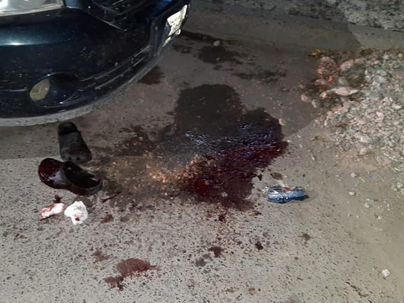 Por viejas rencillas machetea a su vecino en Acu&ntilde;a