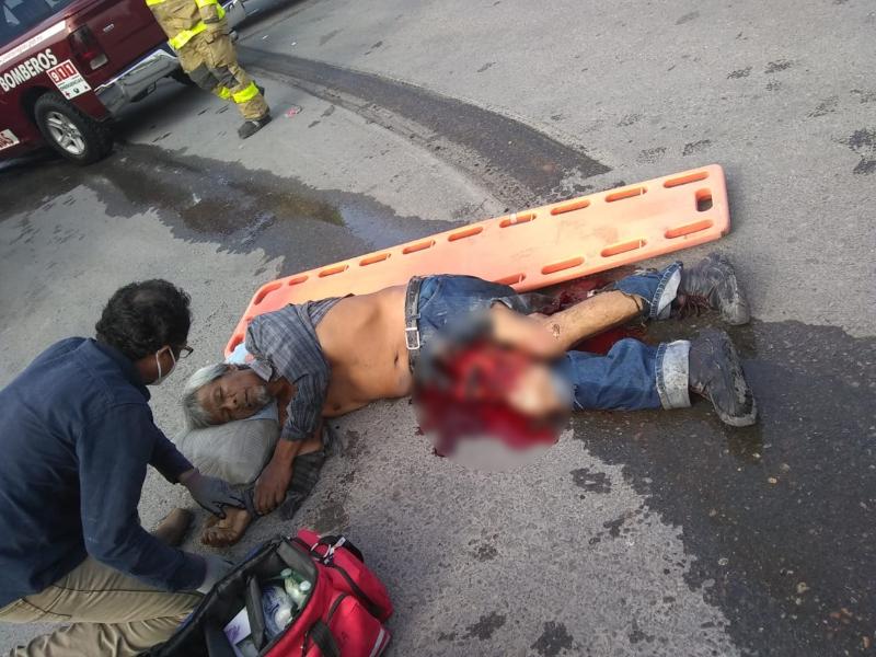 Muere hombre atropellado por un tráiler en la carretera Ribereña 2 (VIDEO)