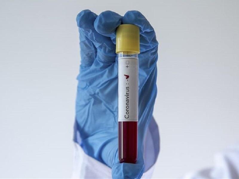 Disminuyen 60% los casos activos de COVID en Piedras Negras, de poco m&aacute;s de 500 ha bajado a 200