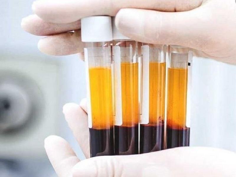 Mejoran s&oacute;lo 6 de 40 casos en los que se us&oacute; plasma en Coahuila