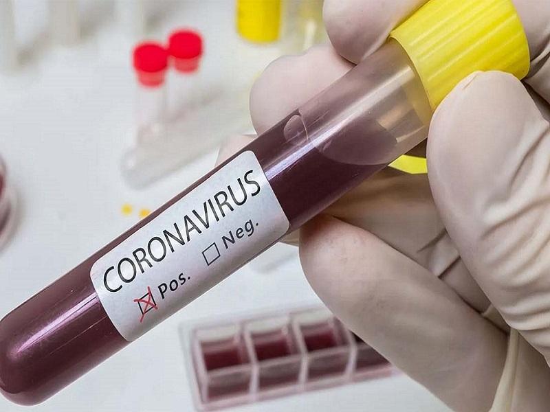 Casos positivos de Covid-19 no se ven reflejados de inmediato en las estad&iacute;sticas