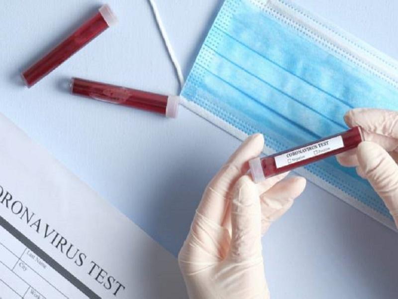 Hay 33.7 millones de contagios de coronavirus en el mundo, EU supera los 7 y Brasil los 4.7 millones