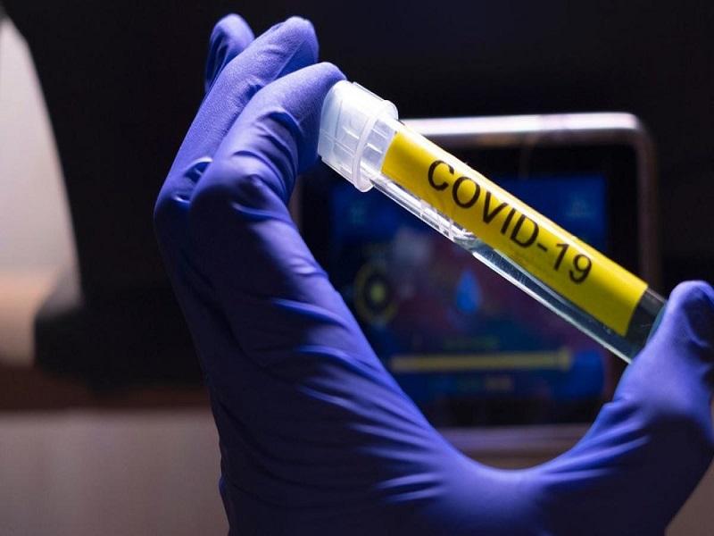 Son hombres mas del 50% de los  casos de COVID-19 en Piedras Negras