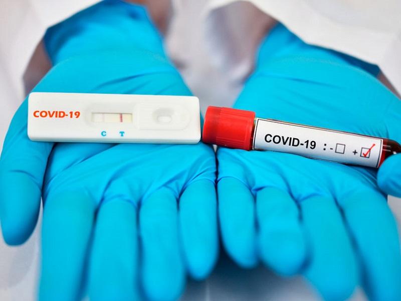 Pruebas rápidas de Covid-19 no son 100% seguras, recomiendan una PCR al obtener resultado positivo (video)