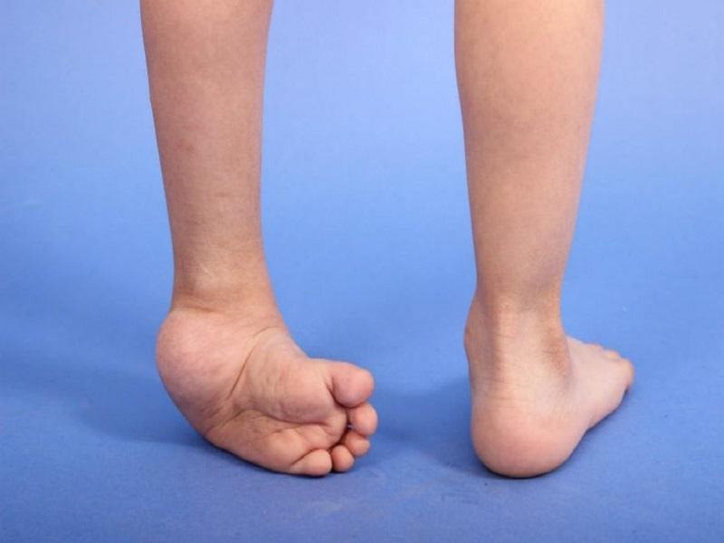 Est&aacute; a punto de terminar 2020 con cero casos de ni&ntilde;os con quemaduras en Piedras Negras