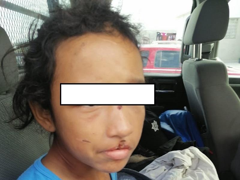 Se niega a declarar madre de Abril Abigail, menor que fue salvajemente golpeada