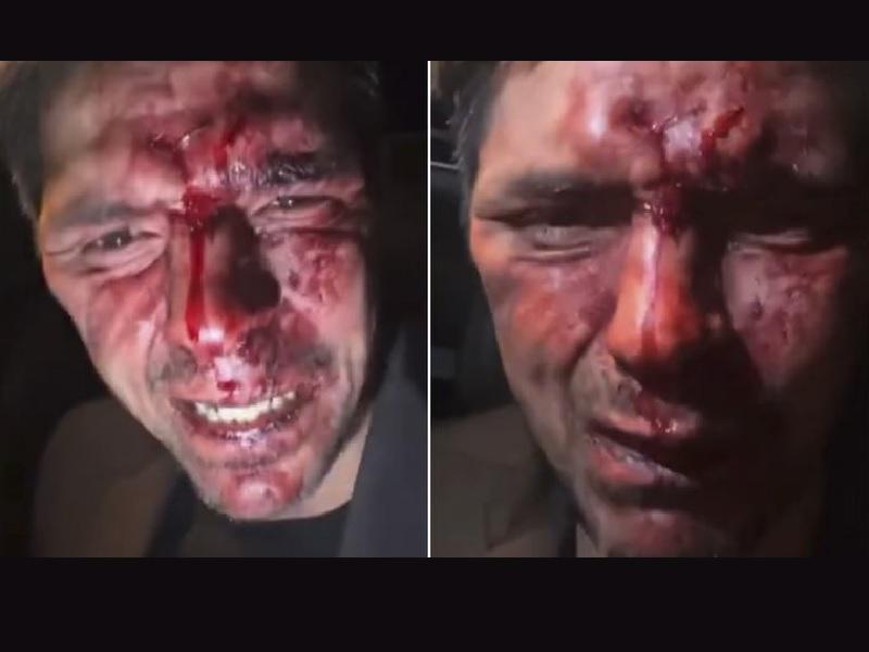 Hijo de Lupita DAlessio acus&oacute; al ex gobernador Arturo Montiel de una terrible golpiza