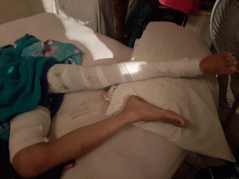 Ni&ntilde;o se quema ambas piernas con cohetes (video)