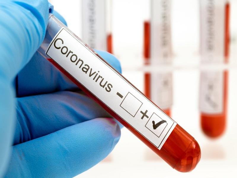 Rebasa Coahuila los 50 mil contagios de coronavirus, acumula 4,056 decesos