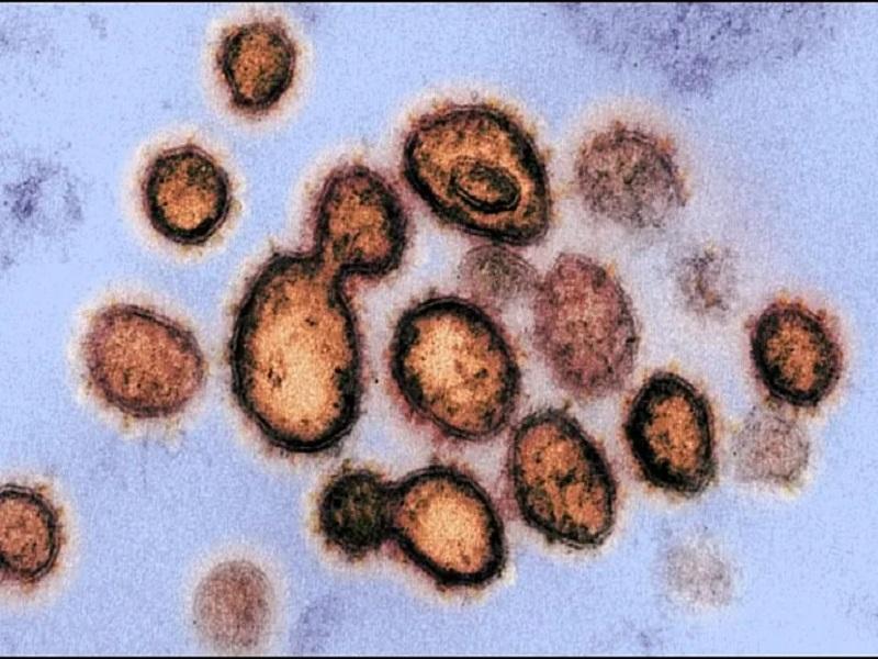 Podr&iacute;a ser mexicana mutaci&oacute;n del COVID-19 detectada en Jalisco 