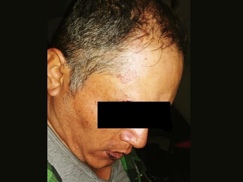 Compa&ntilde;eros de trabajo provocan ri&ntilde;a y resulta uno lesionado con arma blanca en el cuello