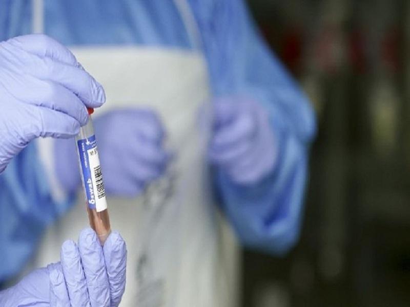 Detectan en Guanajuato primer caso de variante brasile&ntilde;a de COVID-19