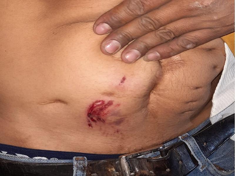 Ataca perro de seguridad de Ferromex a migrante hondureño, sufrió una herida en el abdomen 