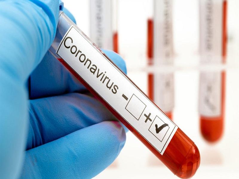 Registr&oacute; Eagle Pass solo 14 nuevos contagios de COVID-19 esta semana