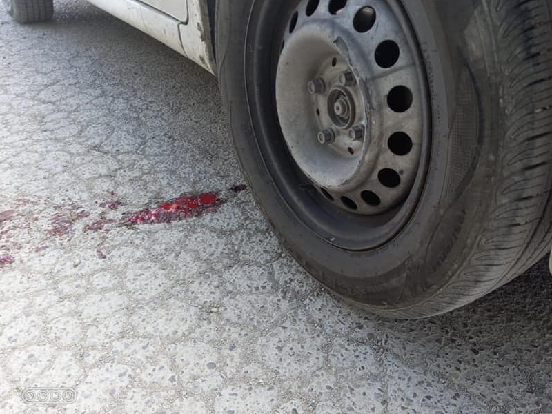 Muere menor de 4 a&ntilde;os despu&eacute;s de ser atropellada en Acu&ntilde;a