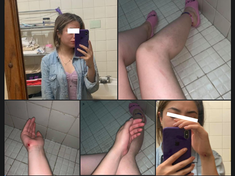 Joven acu&ntilde;ense denuncia en redes sociales el intento de violaci&oacute;n del que fue v&iacute;ctima a plena luz del d&iacute;a