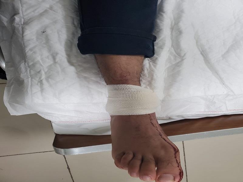 Balean a jefe de seguridad de Ferromex a la altura del Puente Internacional Dos